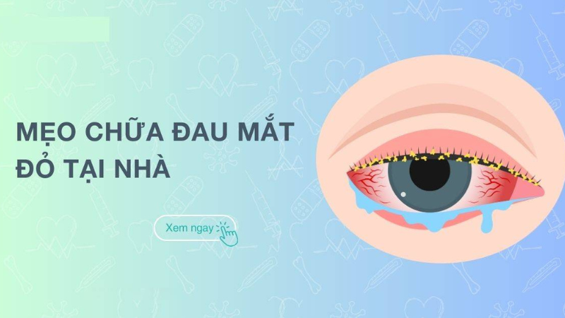 mẹo chữa đau mắt đỏ nhanh nhất