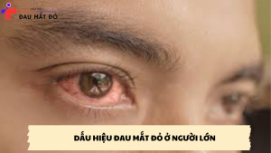 dấu hiệu đau mắt đỏ ở người lớn