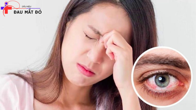 dấu hiệu hết đau mắt đỏ